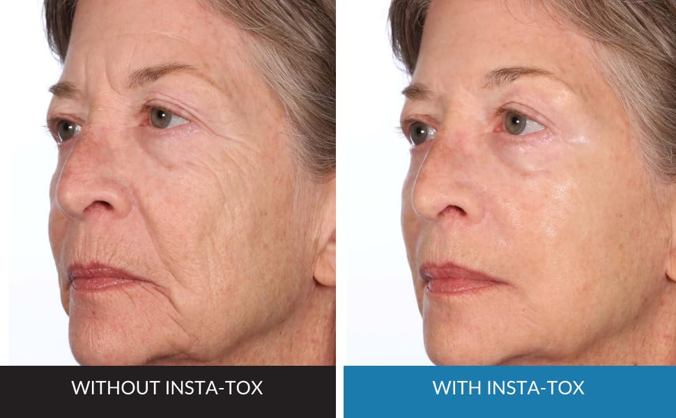 Serious Skincare INSTA-TOX Serum + A Defiance Primer Duo – Wrinkle, Line & Pore Filler