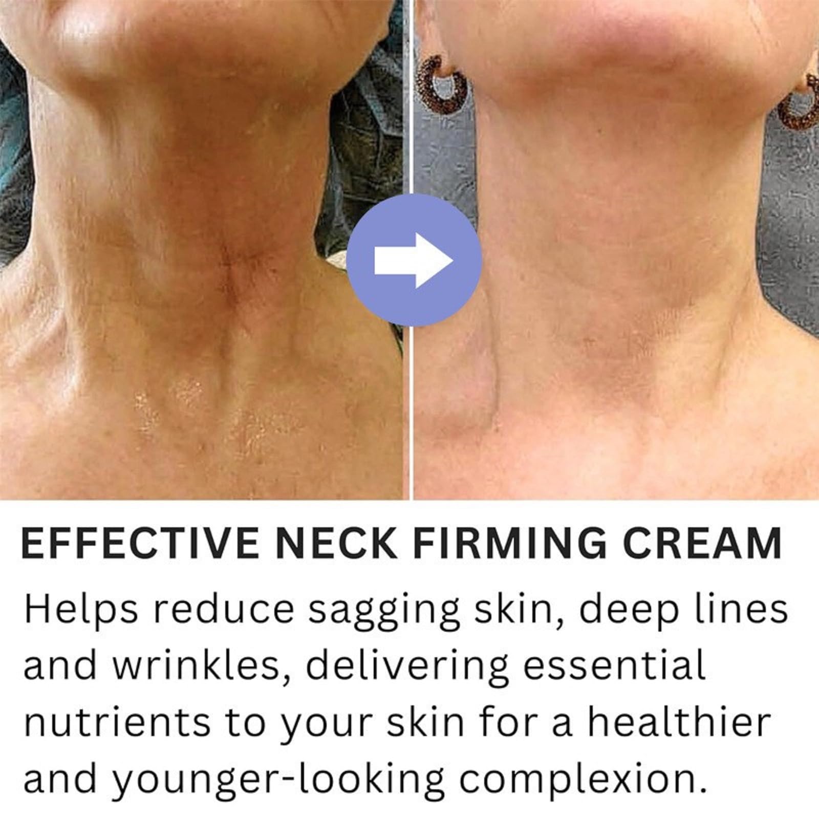 SEWOG Neck Firming Cream - Anti-Wrinkle Neck Moisturizer 1.7 oz