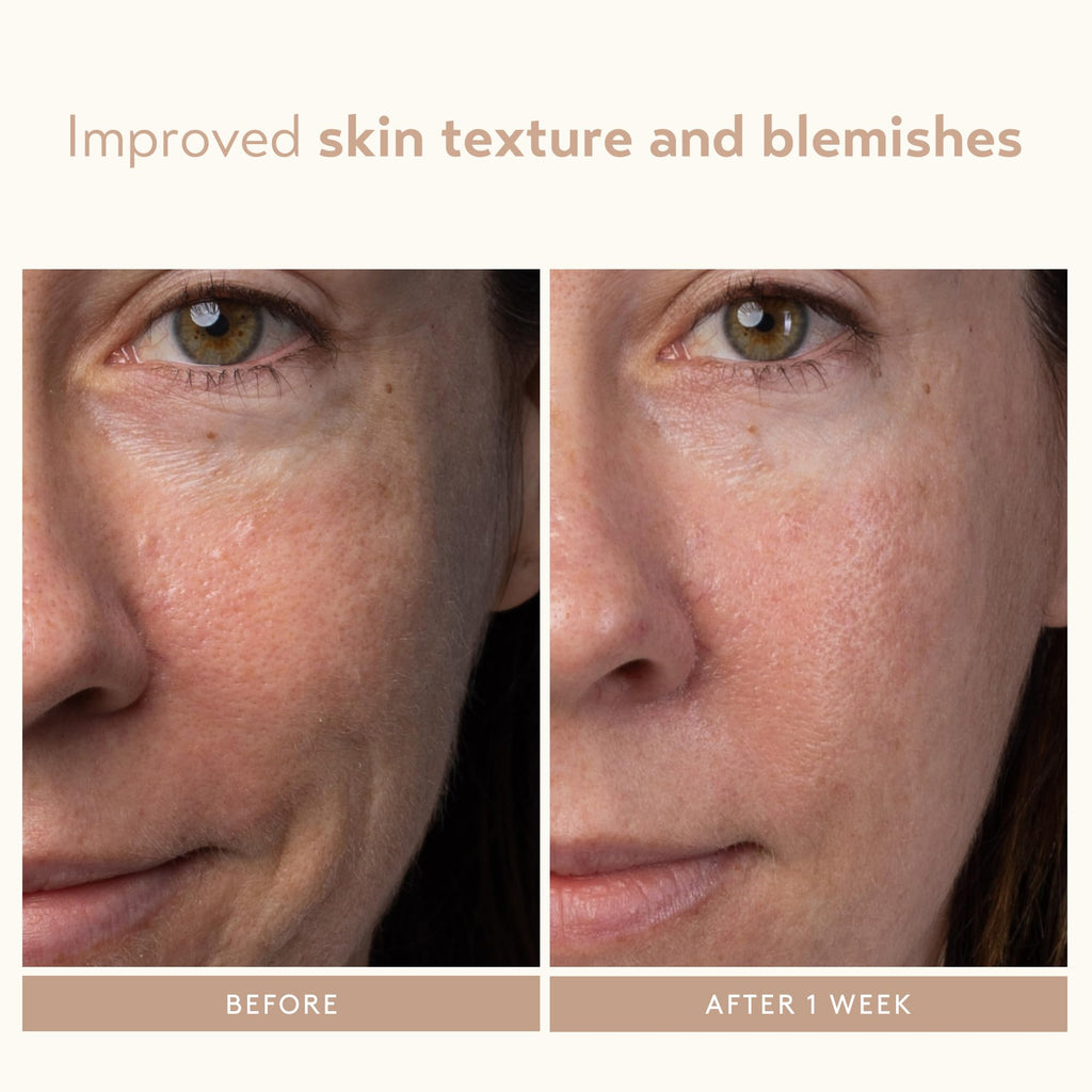 SHANI DARDEN Lactic Acid Serum | Travel Size Night Exfoliator for Radiant, Smooth Skin
