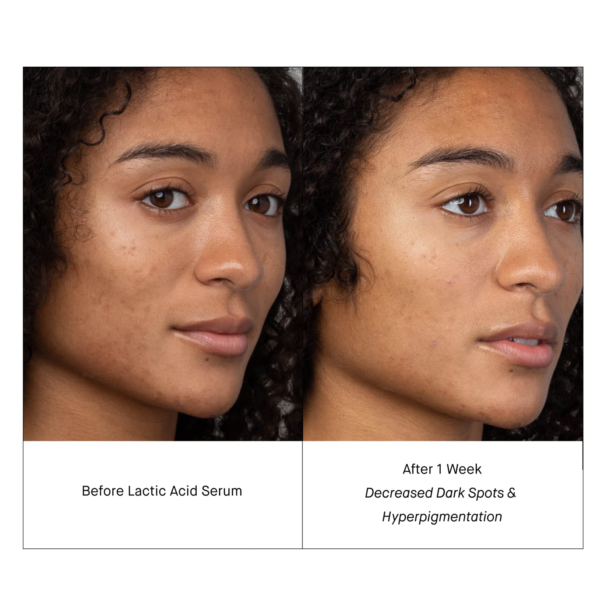 SHANI DARDEN Lactic Acid Serum | Travel Size Night Exfoliator for Radiant, Smooth Skin