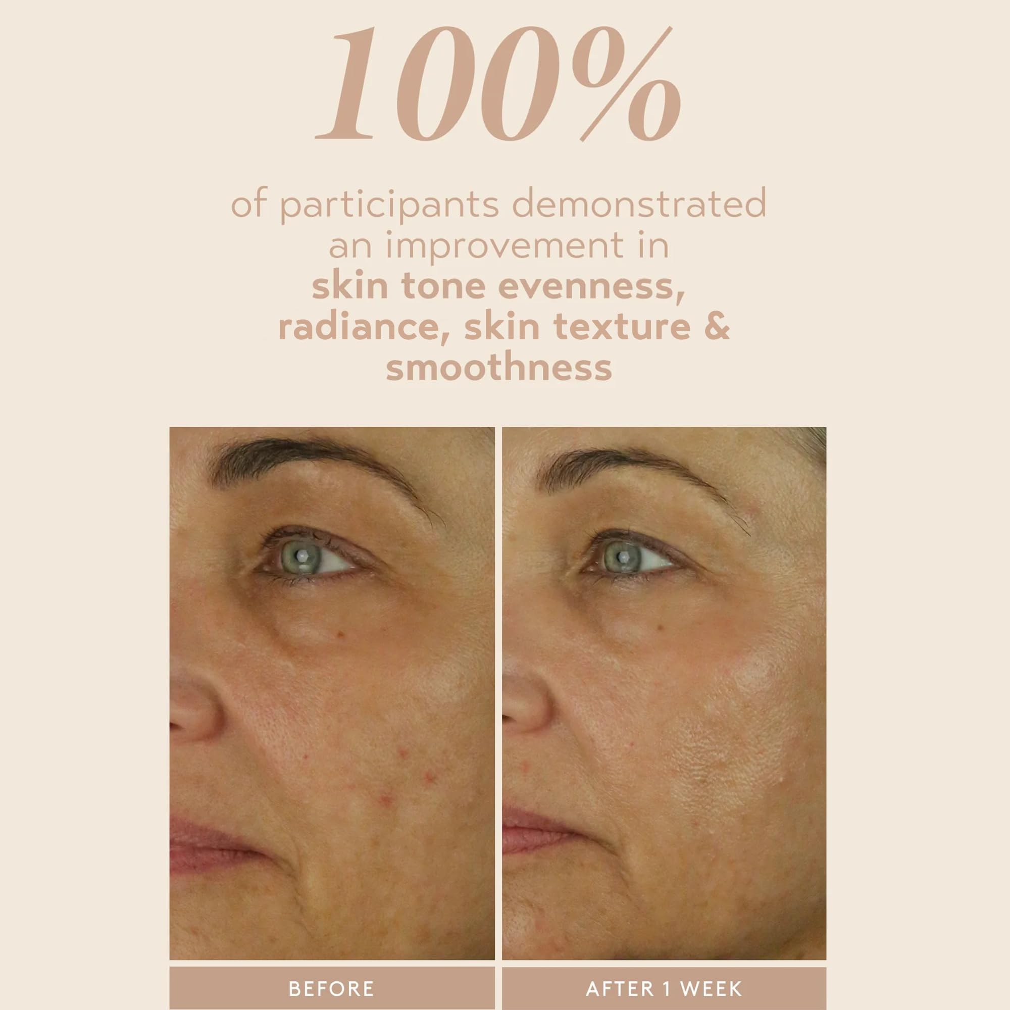 SHANI DARDEN Retinol Reform 1% Encapsulated Retinol Serum for Face & Neck – Gentle, Slow-Release with Tripeptide