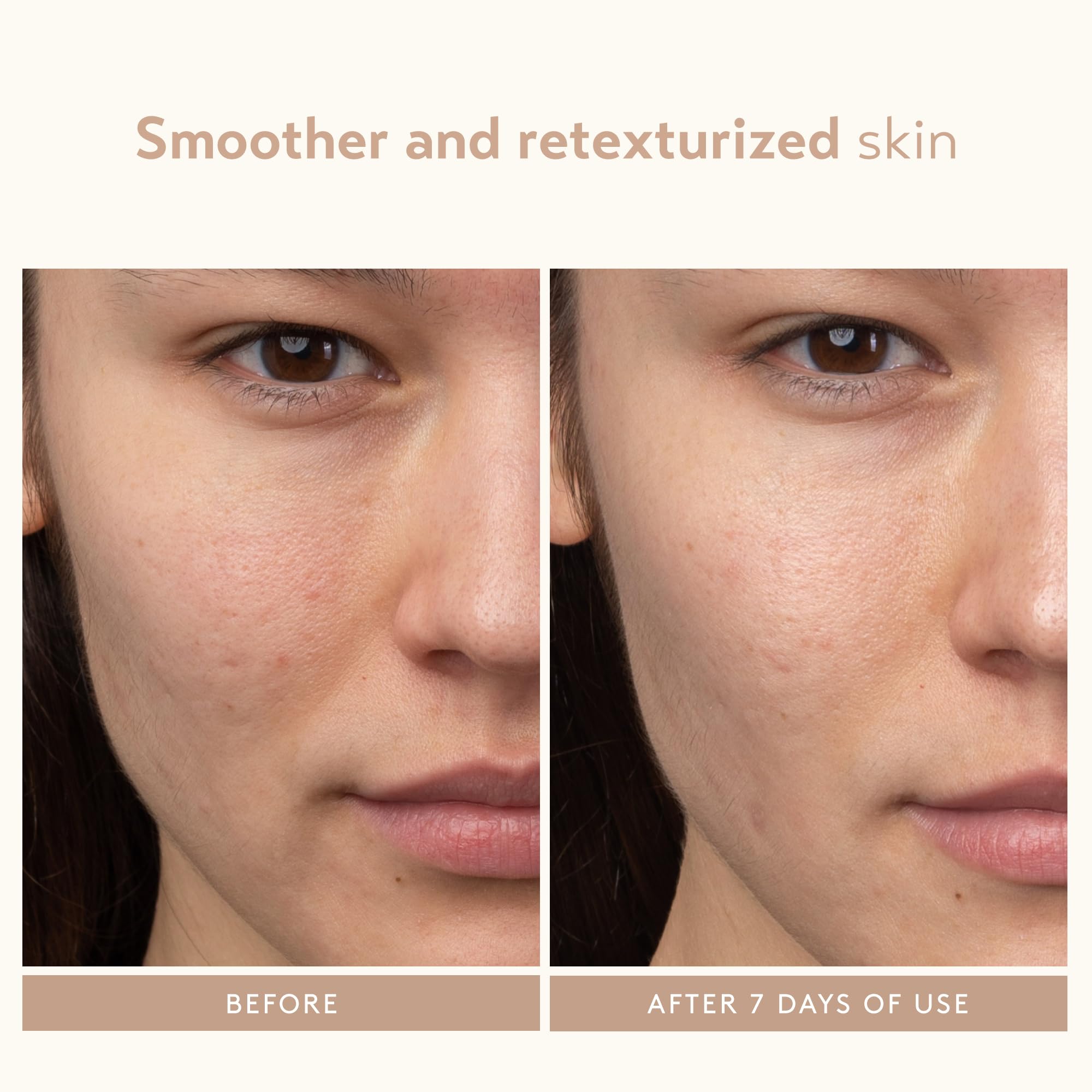 SHANI DARDEN Lactic Acid Face Serum | Night Exfoliating Serum for Radiant, Smooth Skin