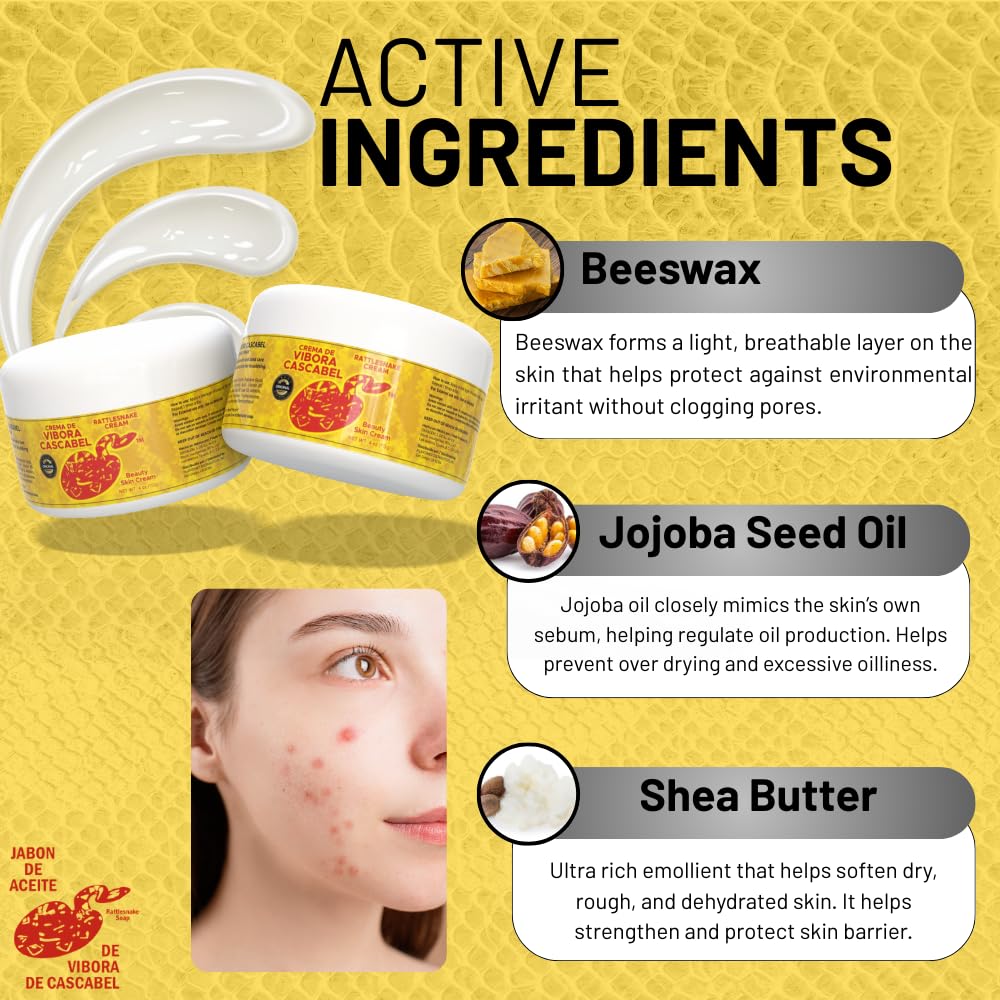 Rattlesnake Venom Cream – Hydrating Moisturizer with Beeswax, Jojoba & Shea Butter – 4 oz