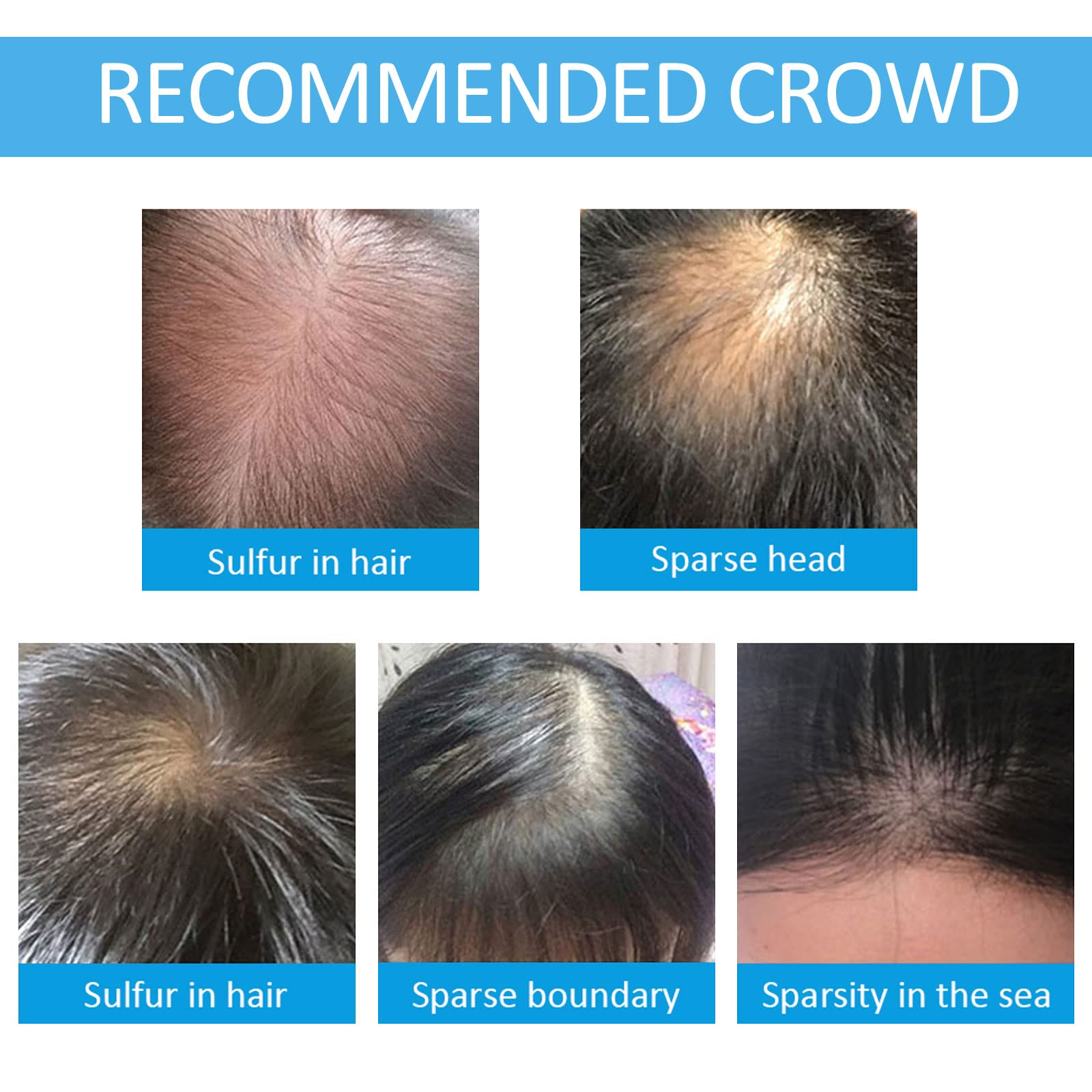SHIFAKOU Hair Building Fibers with Spray Nozzle – Instant Fuller Hair (Dark Brown, 27.5g, 4 Shades)
