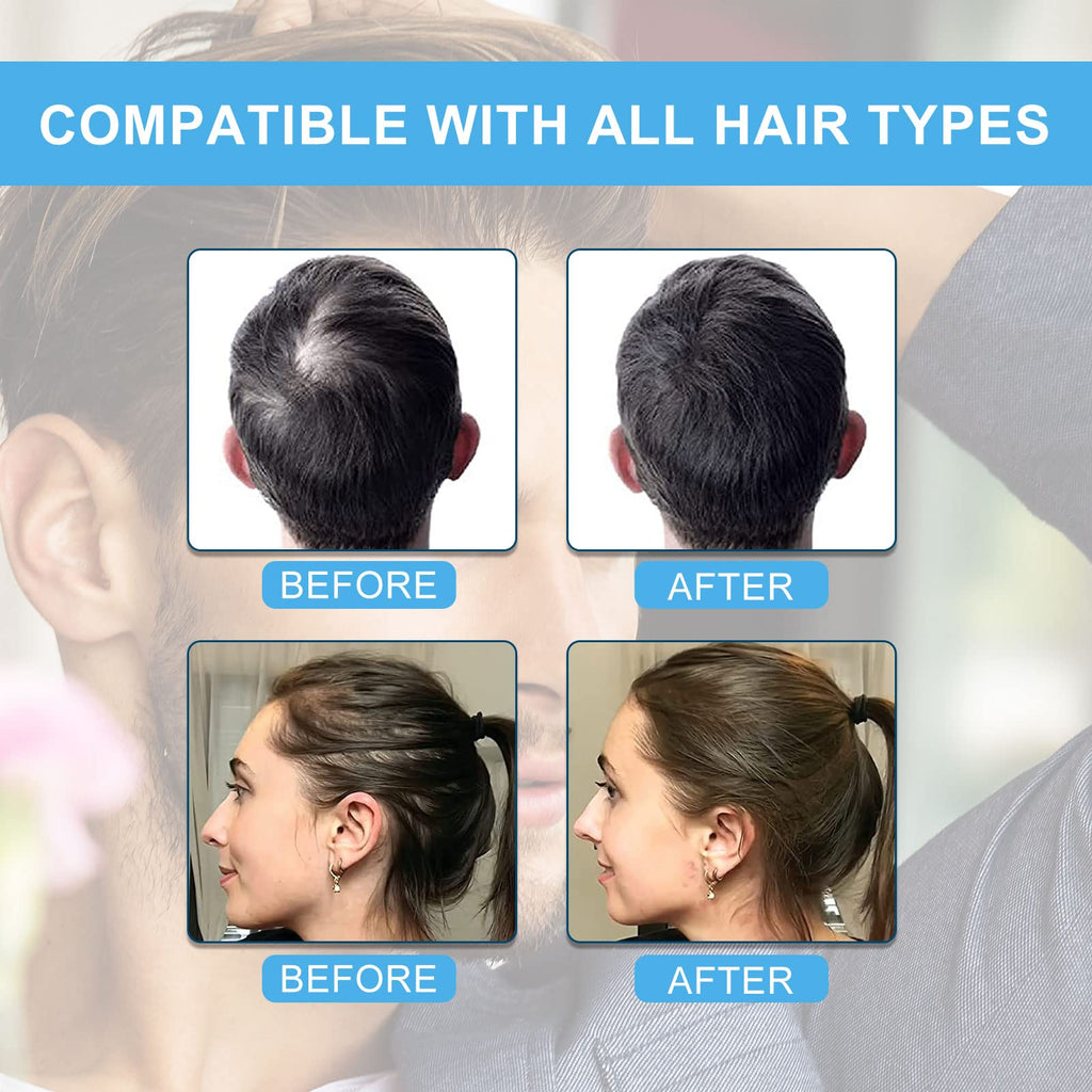 SHIFAKOU Hair Building Fibers with Spray Nozzle – Instant Fuller Hair (Dark Brown, 27.5g, 4 Shades)