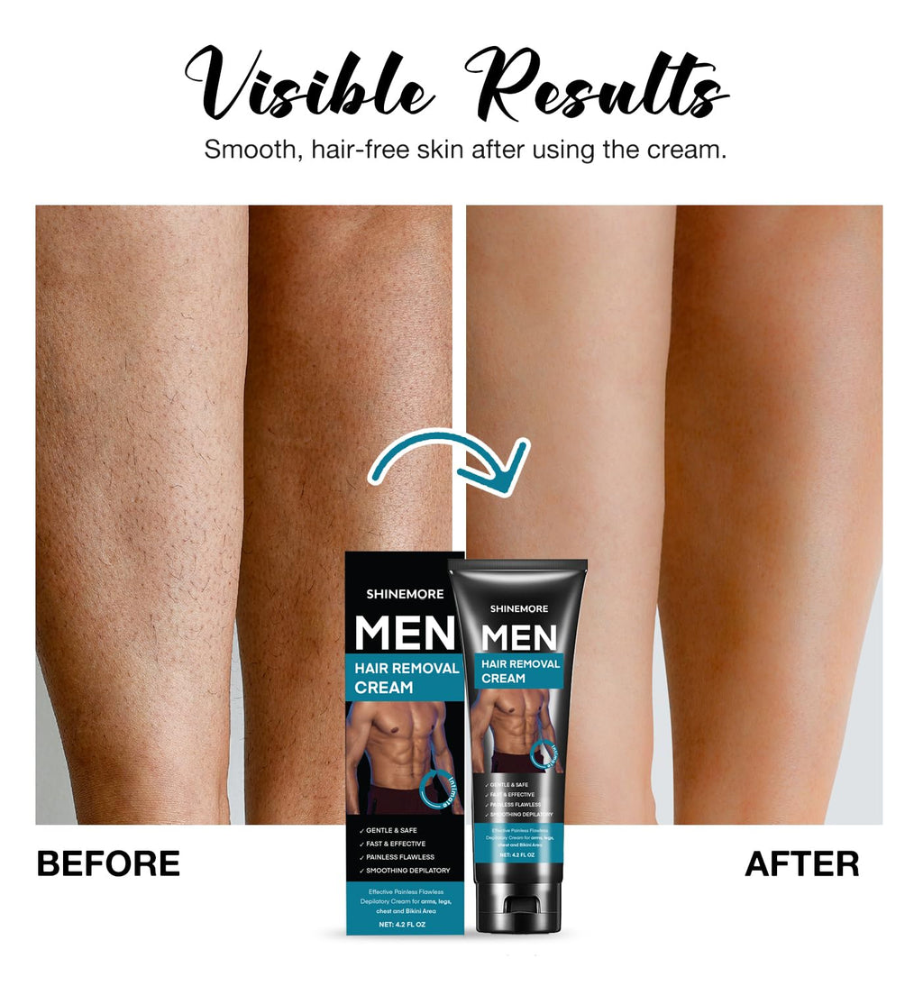 ShineMore Intimate Hair Removal Cream for Men – Pain-Free, Long-Lasting Smoothness (4.2 oz)