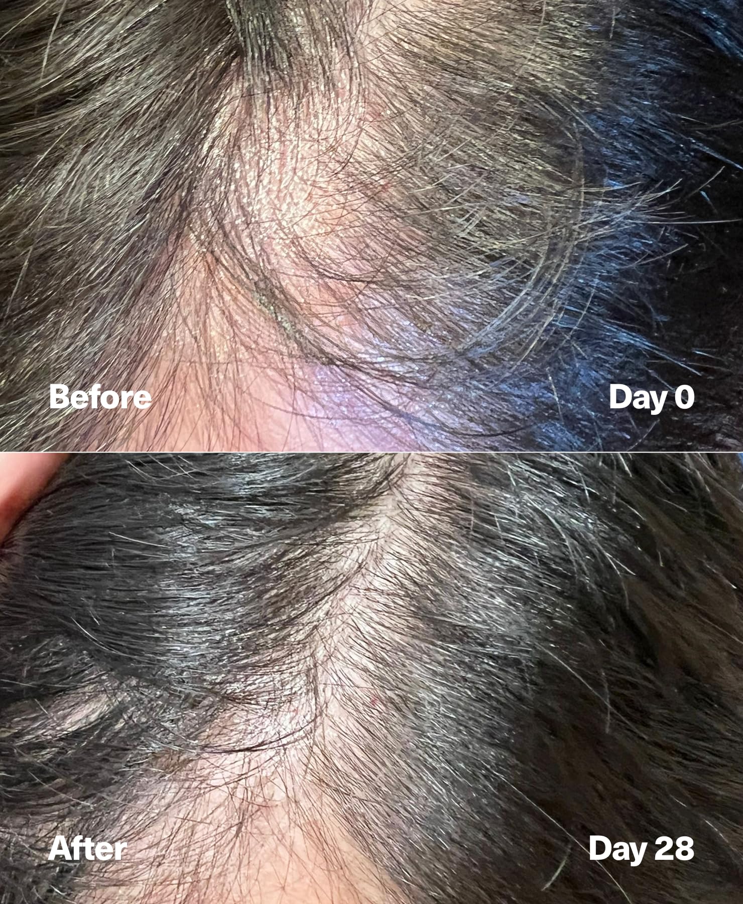 SickScience PowerCycle Exosome Hair Growth Serum – Lightweight, Fragrance-Free, Silicone-Free 60mL