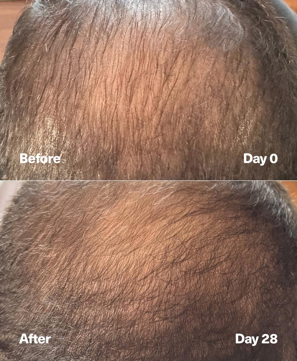 SickScience PowerCycle Exosome Hair Growth Serum – Lightweight, Fragrance-Free, Silicone-Free 60mL