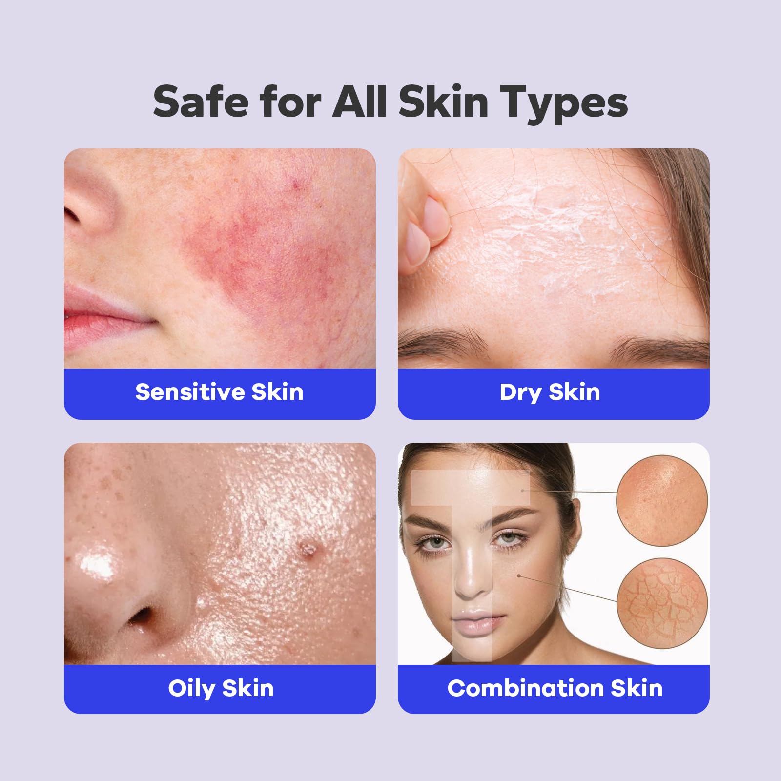 SilkyShark Salicylic Acid Spray — 2% Body Acne Treatment, 360° Mist