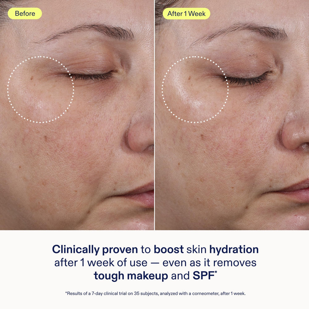 Skinfix Ceramide + Ectoin Gentle Gel Cleanser – 5 oz | Removes Makeup & SPF | Vegan & Cruelty-Free