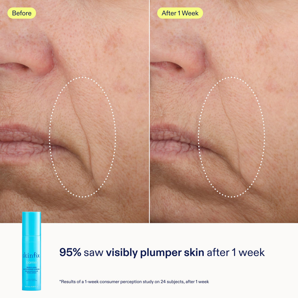 Skinfix Barrier+ Kit – Mini Cream, Cleanser & Serum | Vegan & Cruelty-Free