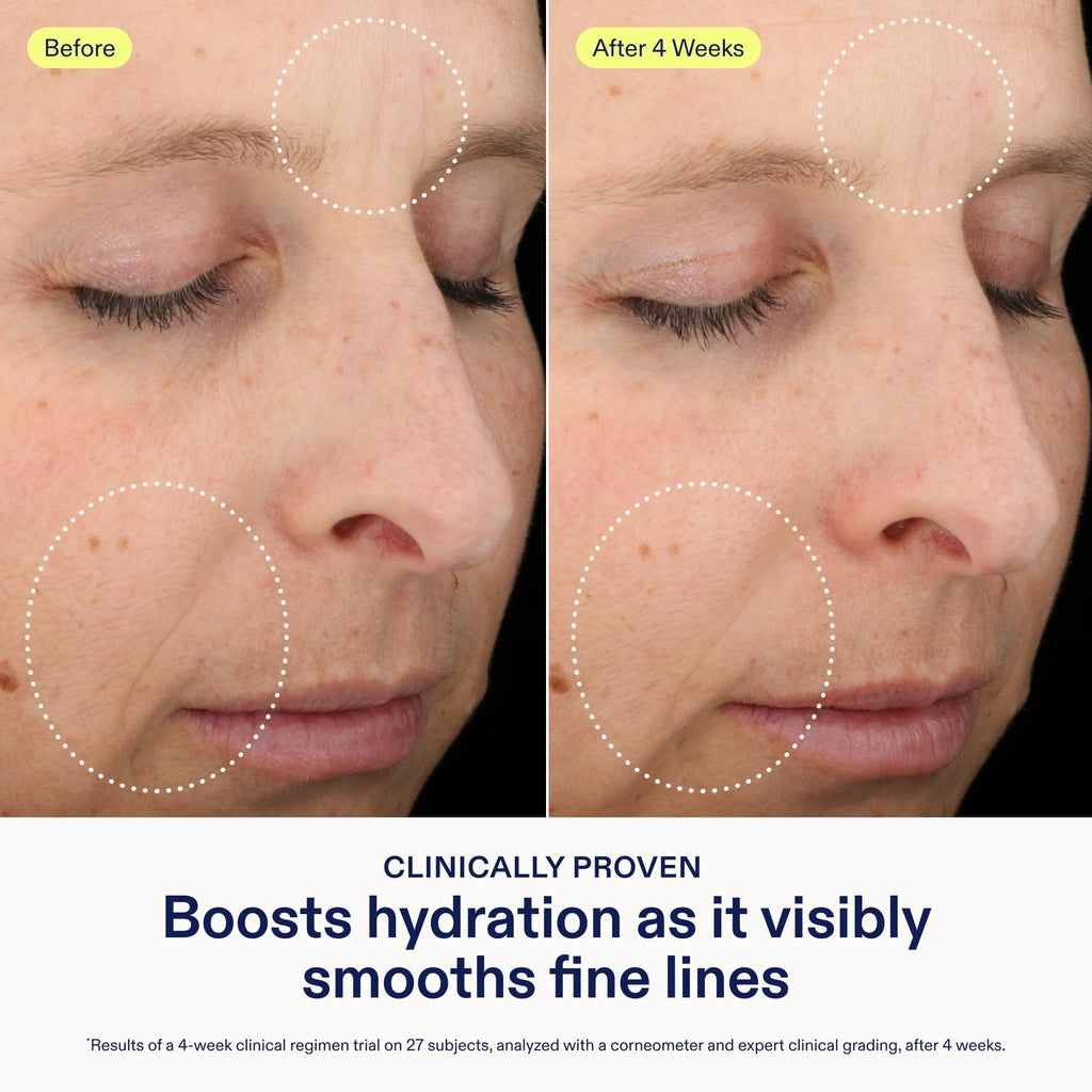 Skinfix Triple Lipid-Hyaluronate Serum | Hydrating Facial Serum 1 oz