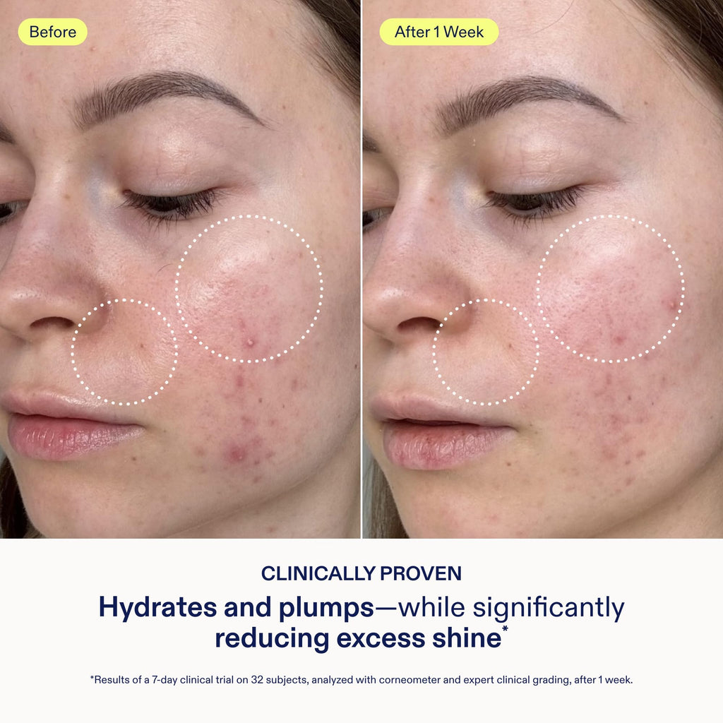 Skinfix Triple Threat Set – Fragrance-Free Minis (BHA Cleanser, Adapinoid Gel, Barrier Gel Cream) – Vegan & Cruelty-Free