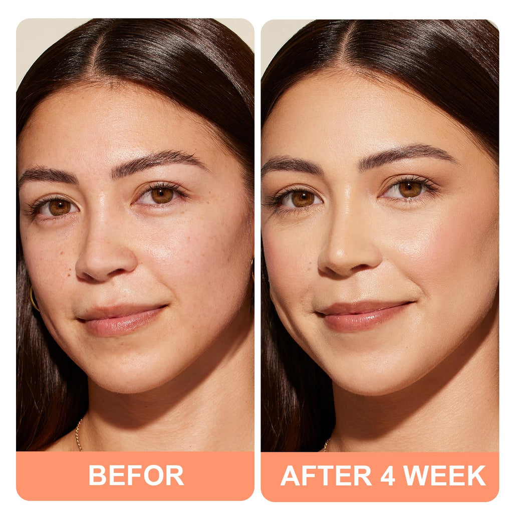 SKSOYT Triple Power Anti-Aging Moisturizer – Retinol, Hyaluronic Acid, Vitamin C & Niacinamide