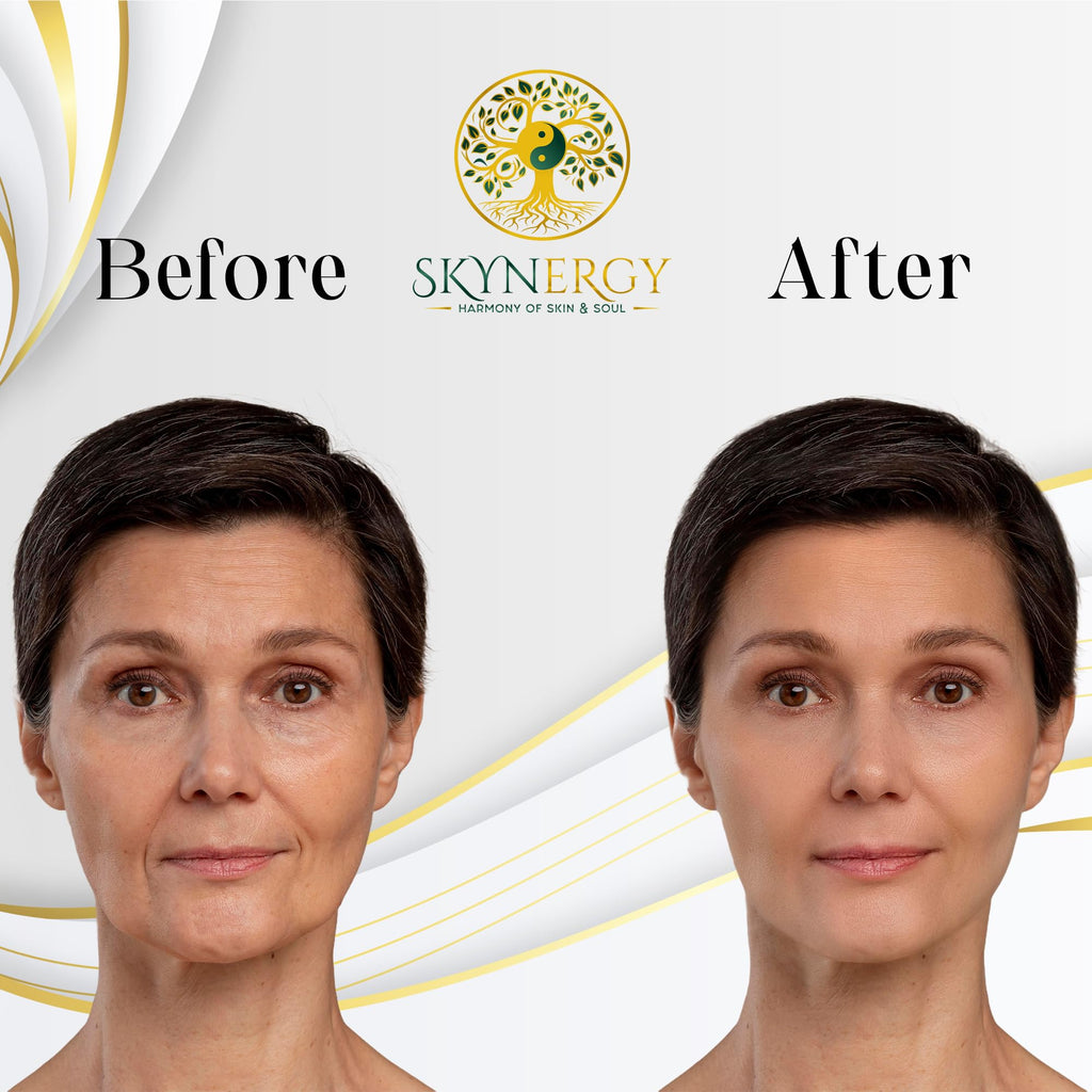 SKYNERGY Bakuchiol Rejuvenation Jelly Mask - HydroGlo Peel Off Face Mask | Radiance, Fine Lines & Pigmentation | Vajafacial Jelly Mask | 12 Applications (30 Fl Oz)