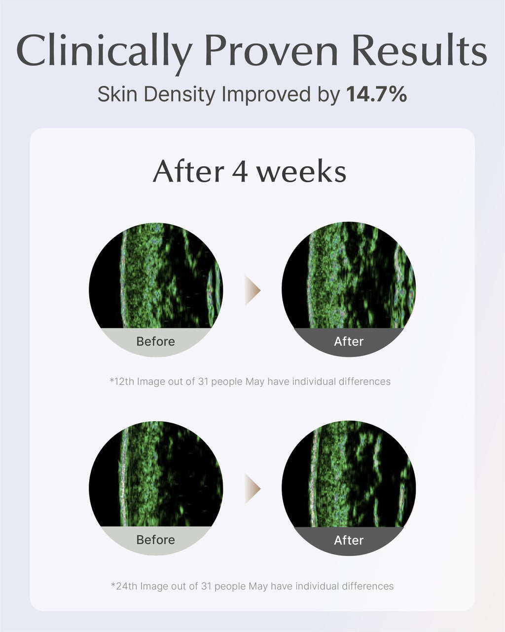 SOORYEHAN Lifting Ampoule Serum – 2.02 fl oz | Niacinamide 5% & Triple Collagen