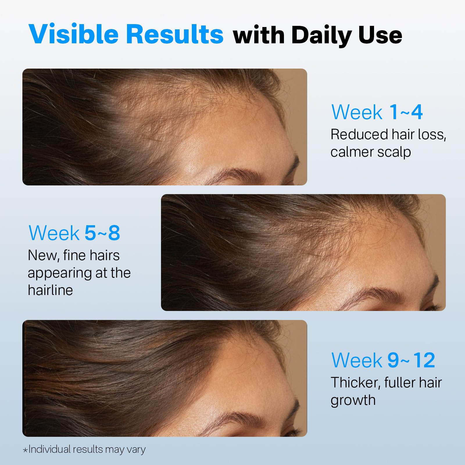 SORNBEO Hair Growth Serum Roll-On – Rosemary & Saw Palmetto, Non-Greasy Scalp Serum, 0.84 fl oz