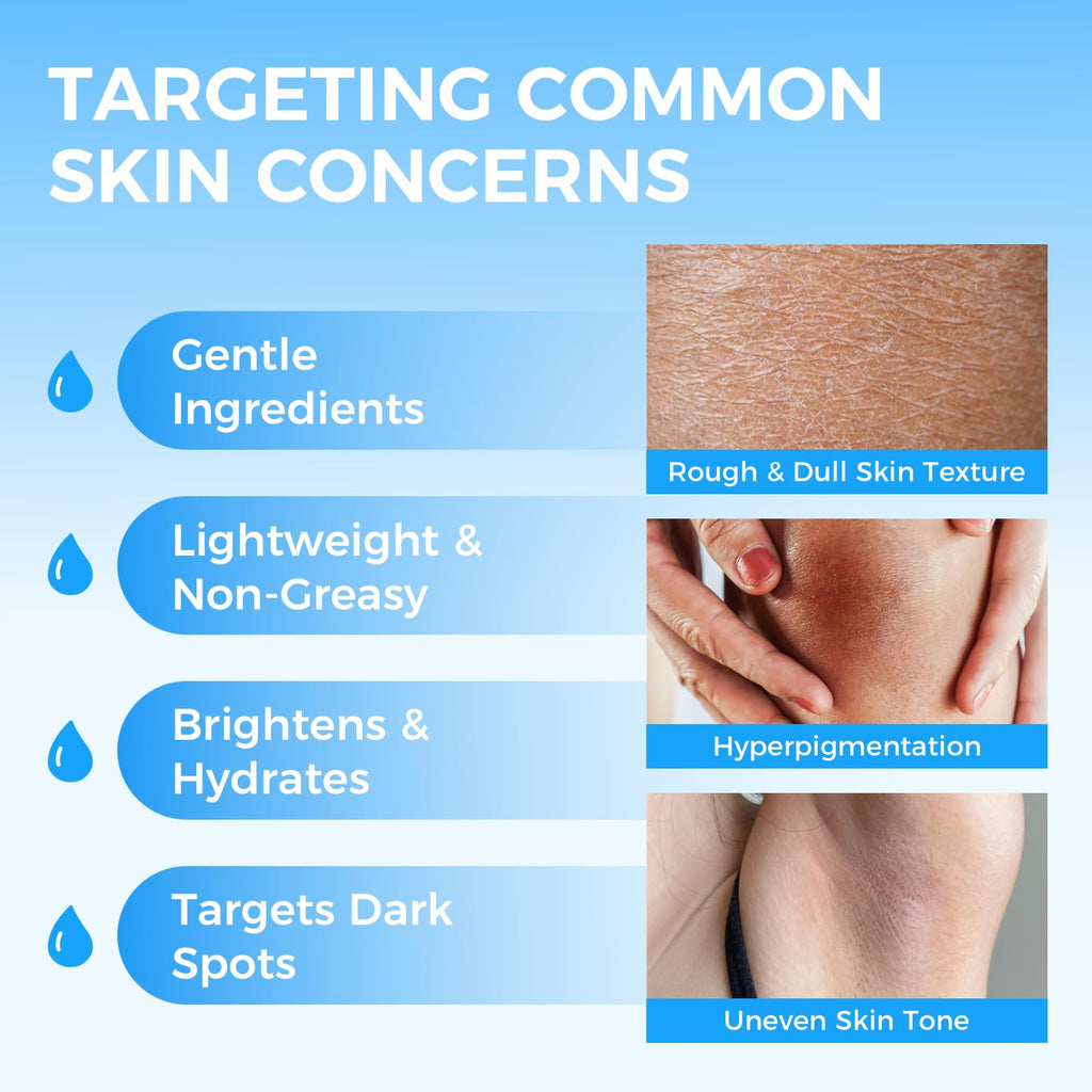 Sperandi Moisturizing Dark Spot Remover for Body with Vitamin C – Gentle Lightening Cream for Underarms, Bikini Line & More (1.7 fl oz)