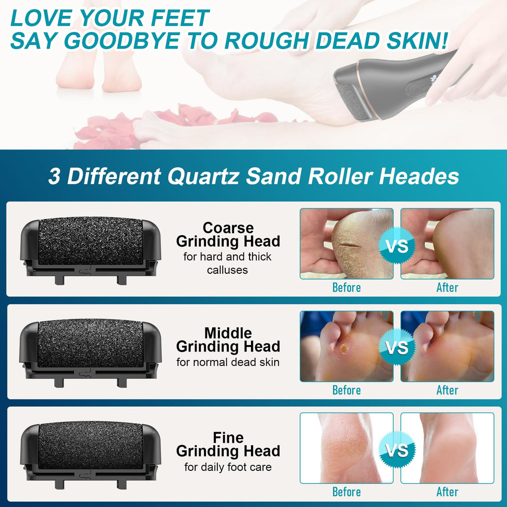 Spriak 16-in-1 Electric Callus Remover Kit – Rechargeable Foot Care Tool for Home Pedicure