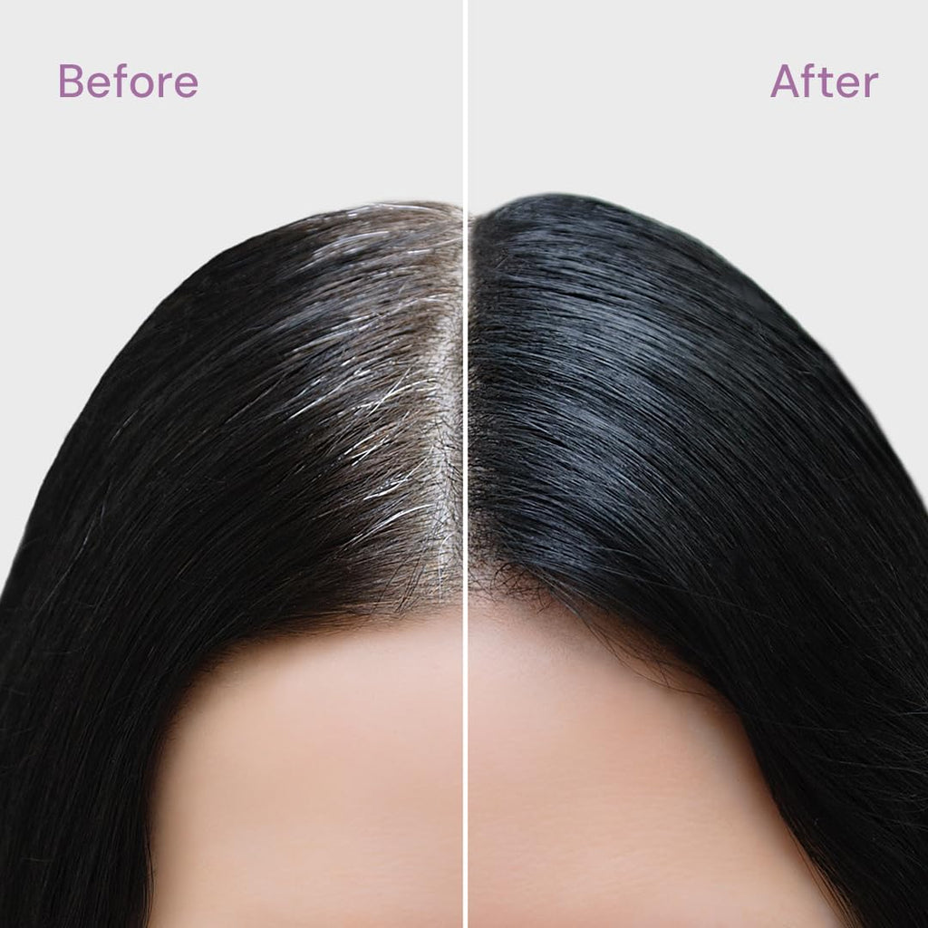 STYLE EDIT Root Concealer Touch Up Spray – Dark Brown, Pack of 5 (2 oz each) | Salon Quality