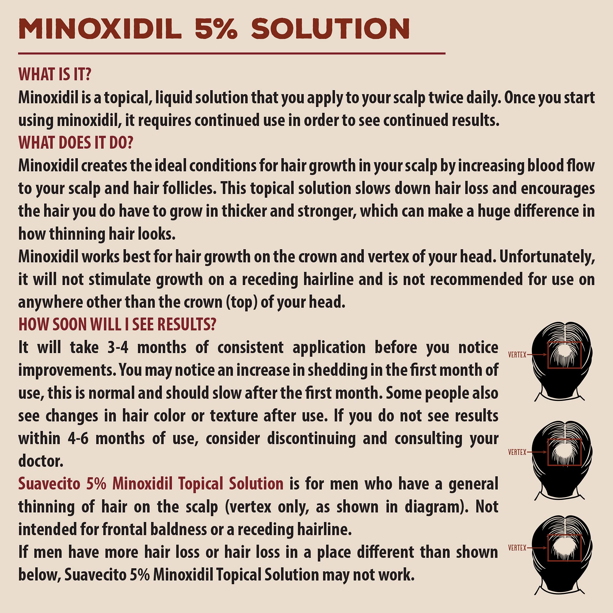 Suavecito Hair Loss Treatment Kit – Minoxidil 5%, Thickening Shampoo & Conditioner, Matte Hair Cream with DHT Blocker (1 Month)