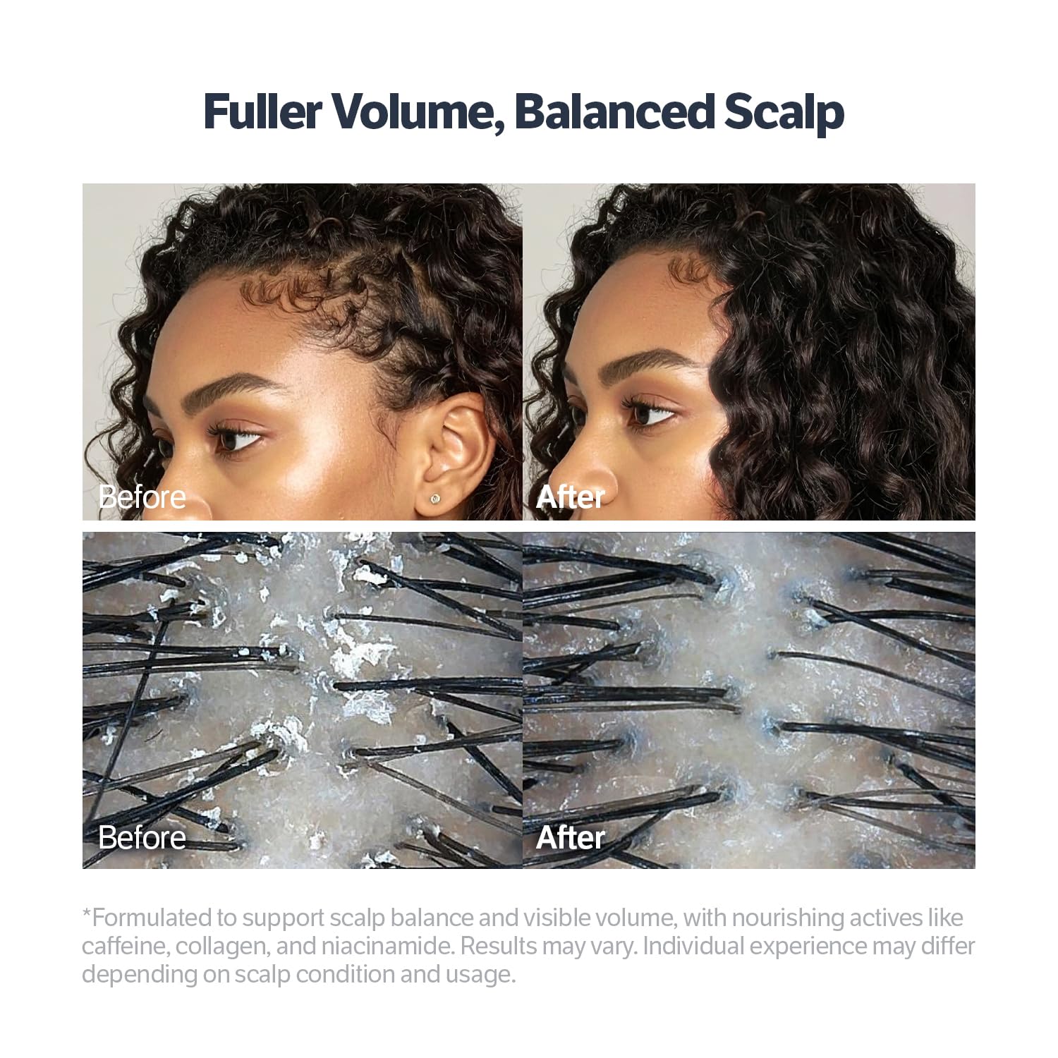 SUNGBOON EDITOR Deep Collagen Retinol Scalp Serum | Roll-On Hair Growth & Thickening