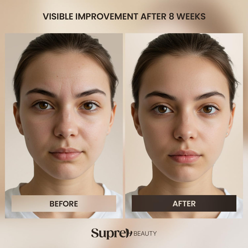 SupreH Bee Venom Cream Wrinkle Filler – Instant Lift & Eye Tightener, 50 ml