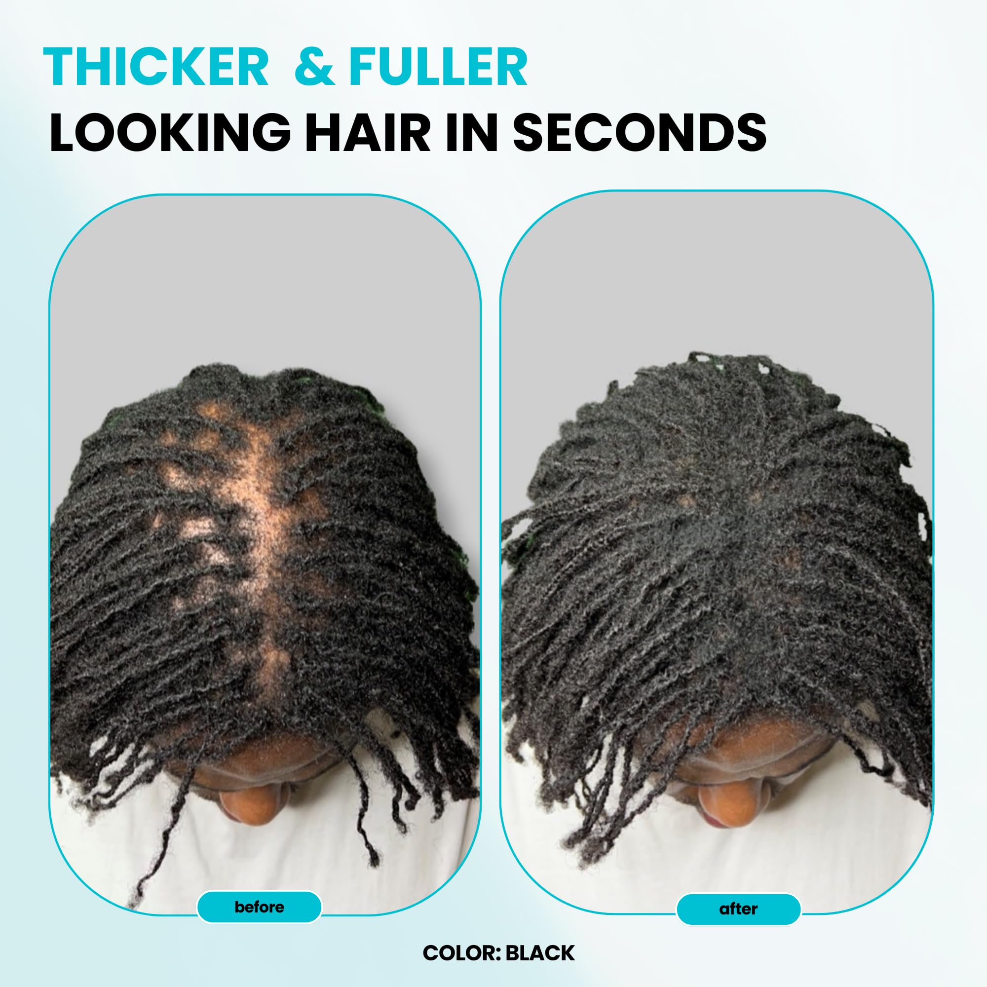 SURETHIK Medium Brown Hair Fibers for Thinning Hair - 30g | Instant Fuller Look for Men & Women