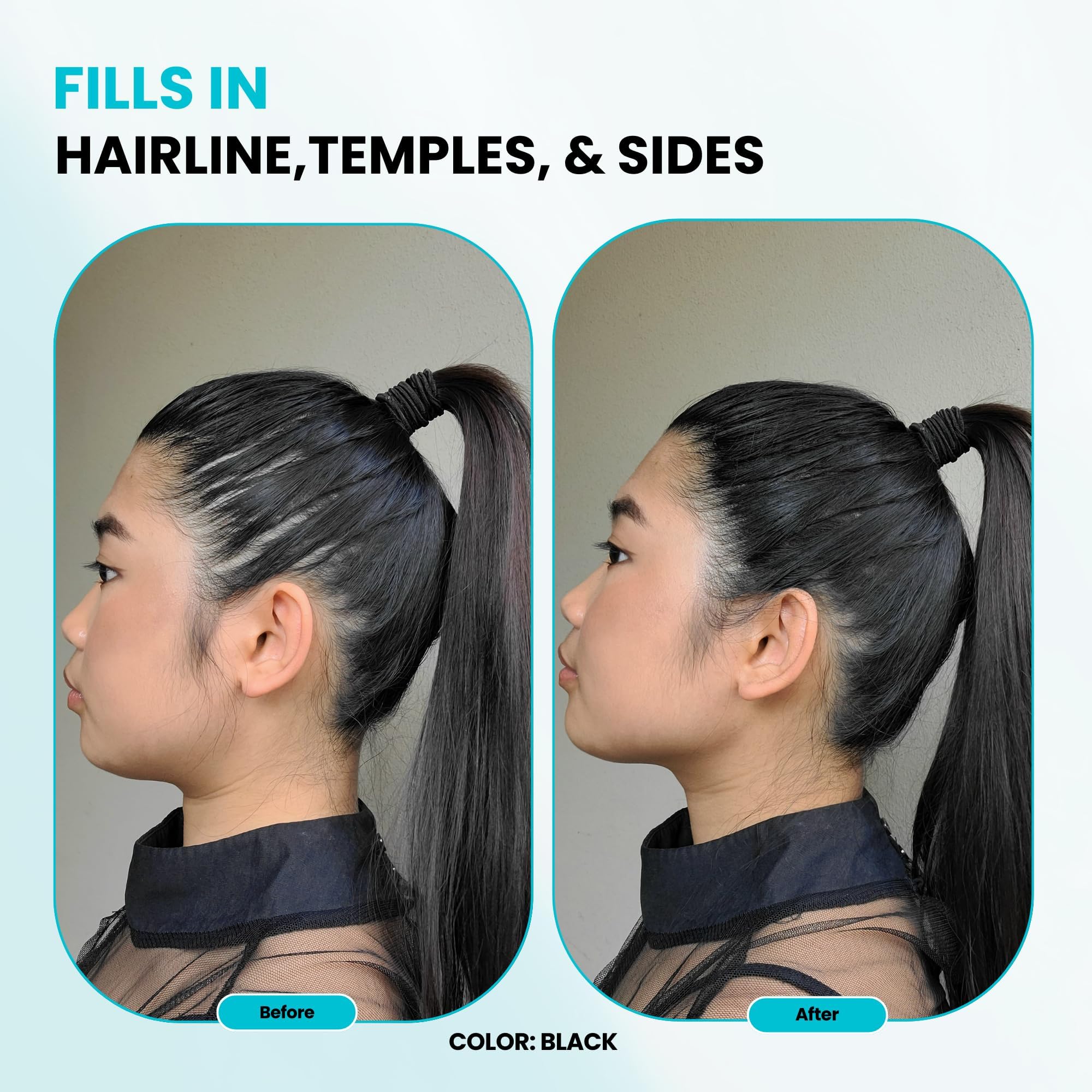 SURETHIK Light Blonde Hair Fibers – Instantly Fuller Look for Thinning Hair (30g)