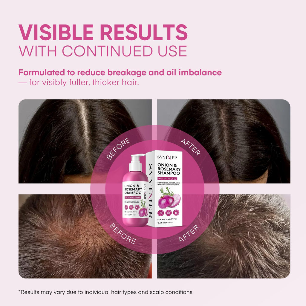 Svvimer Onion Rosemary & Biotin Shampoo — Volumizing, Sulfate-Free Hair Thickening 13.5 oz (Pack of 1)