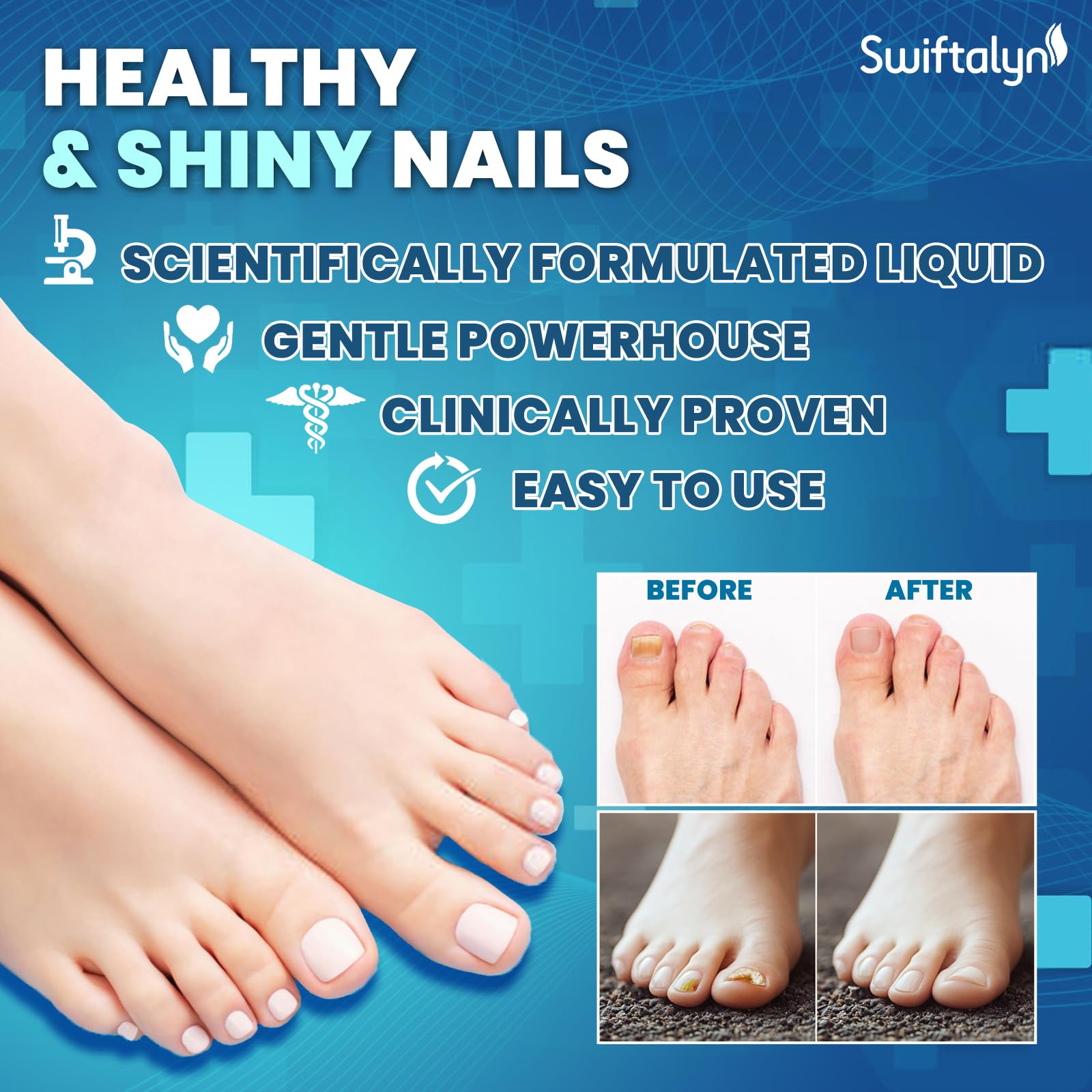 Swiftalyn Extra Strength Nail Solution with Brush – Toenail & Nail Care (20ml)