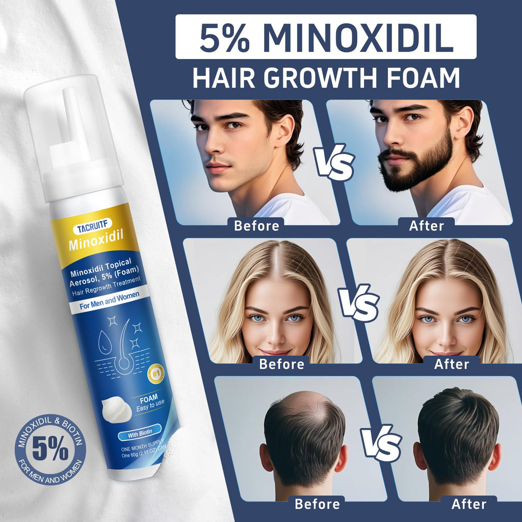 Tacruitf 4-Pack Minoxidil Foam 5% – Hair & Beard Growth, Biotin-Infused, 8.44 oz