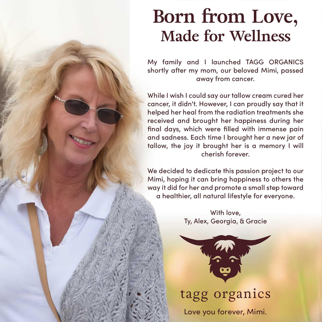TAGG ORGANICS Organic Whipped Tallow Cream – Frankincense, 100% Grass-Fed, Deep Moisture, 4 oz