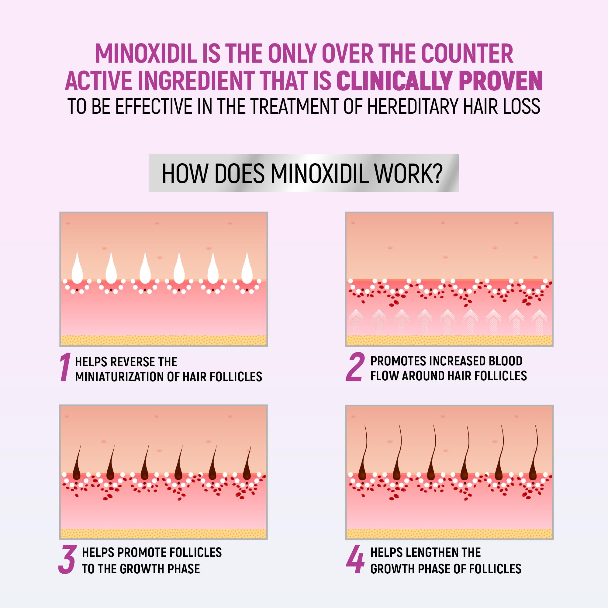 TARO Minoxidil for Women 5% Foam – 2.11 Oz (2 Months) Hair Regrowth Treatment