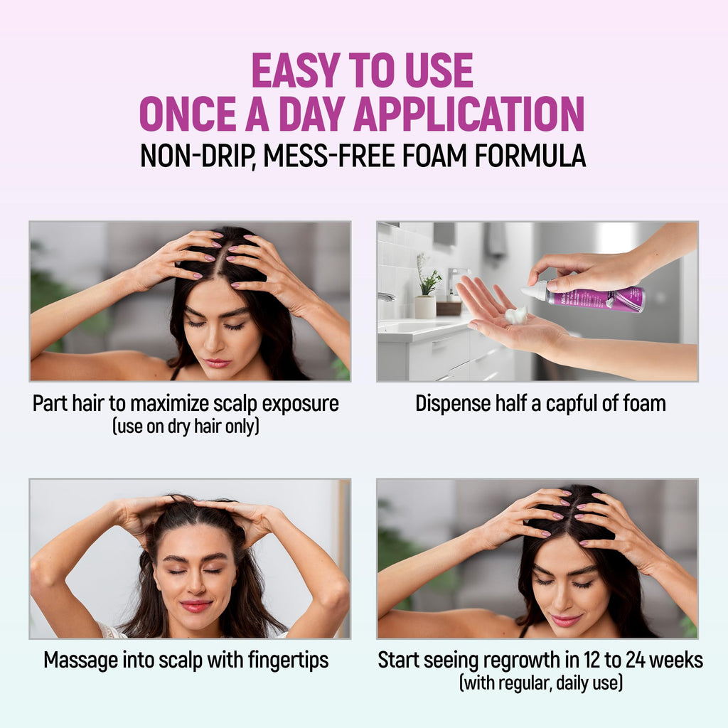 TARO Minoxidil for Women 5% Foam – 2.11 Oz (2 Months) Hair Regrowth Treatment