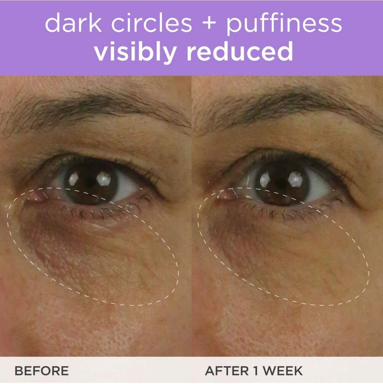 TATCHA The Brightening Eye Cream | Brightening & Dark Circle Reduction with Vitamin C for Bright, Firm Under-Eyes, 15 ml / 0.5 fl oz