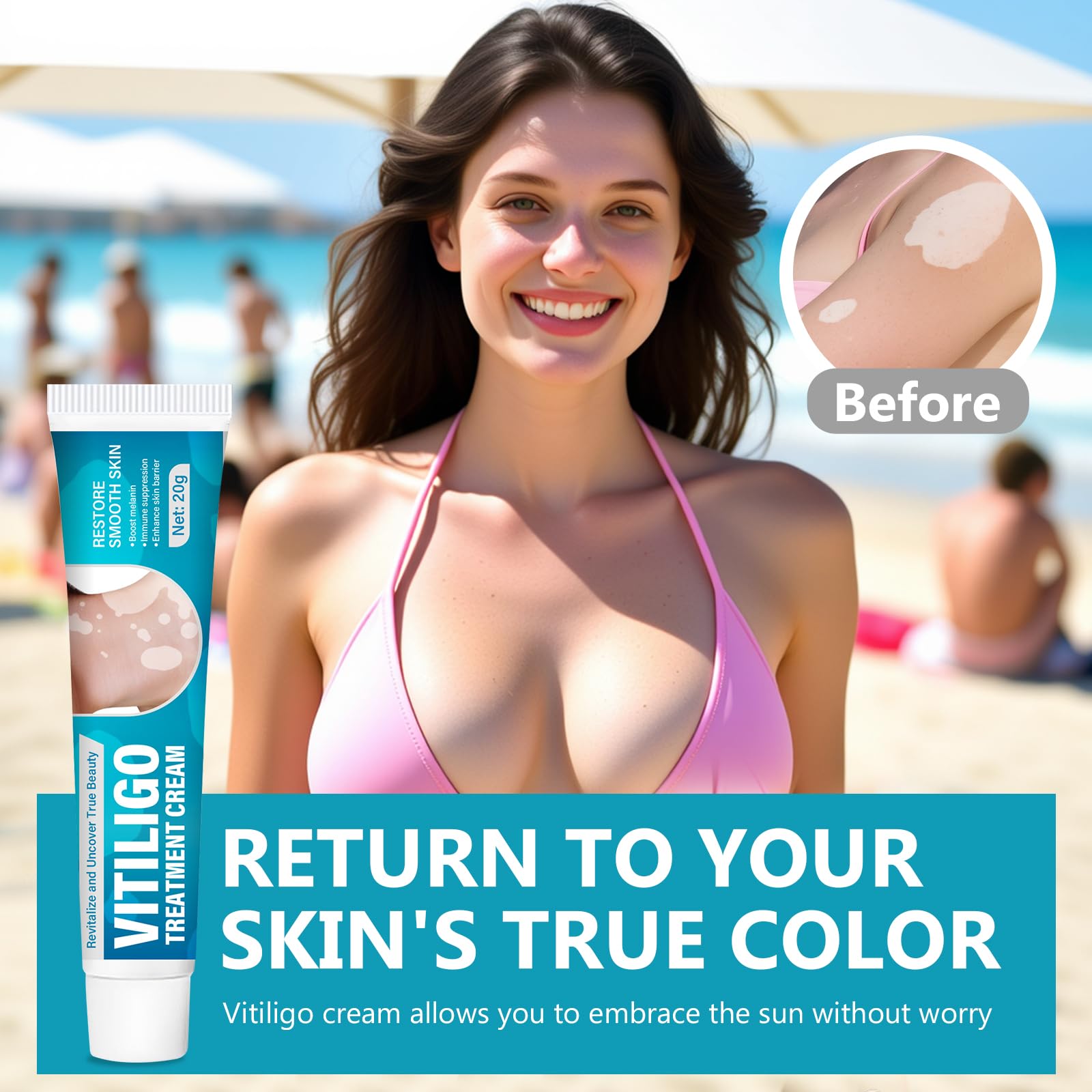 TDZLDM Vitiligo Cream - Natural White Spot Treatment for Face and Body
