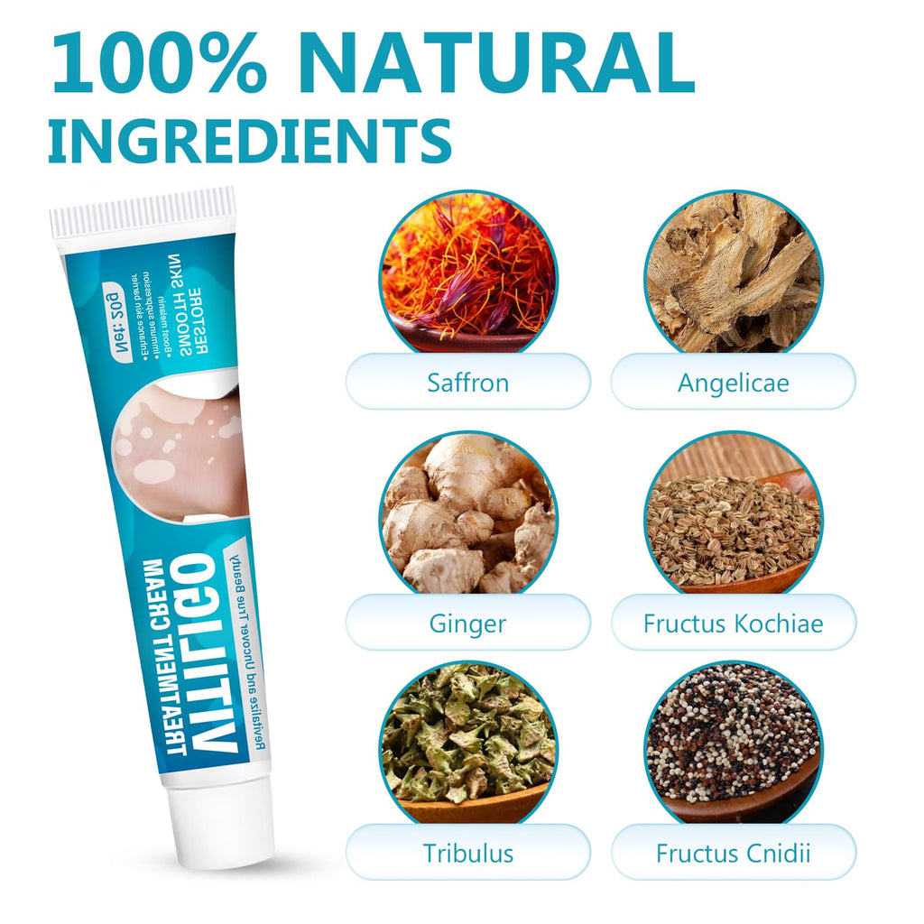 TDZLDM Vitiligo Cream - Natural White Spot Treatment for Face and Body