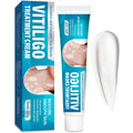TDZLDM Vitiligo Cream - Natural White Spot Treatment for Face and Body