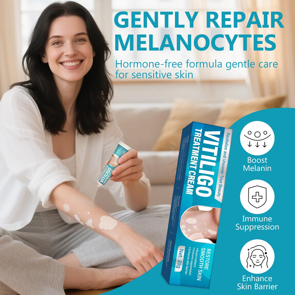 TDZLDM Vitiligo Cream - Natural White Spot Treatment for Face and Body