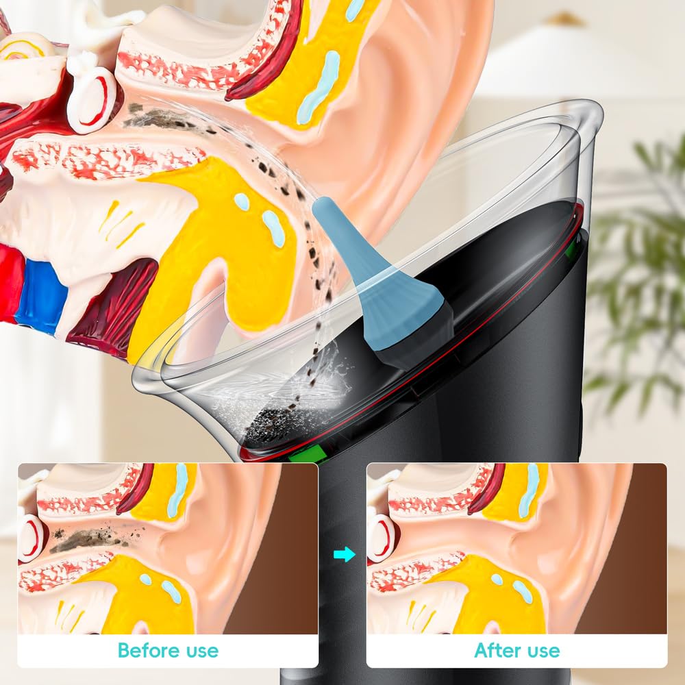 Temodu Ear Wax Removal with LED Display - Rechargeable Ear Cleaner, 3 Modes, 12 Tips