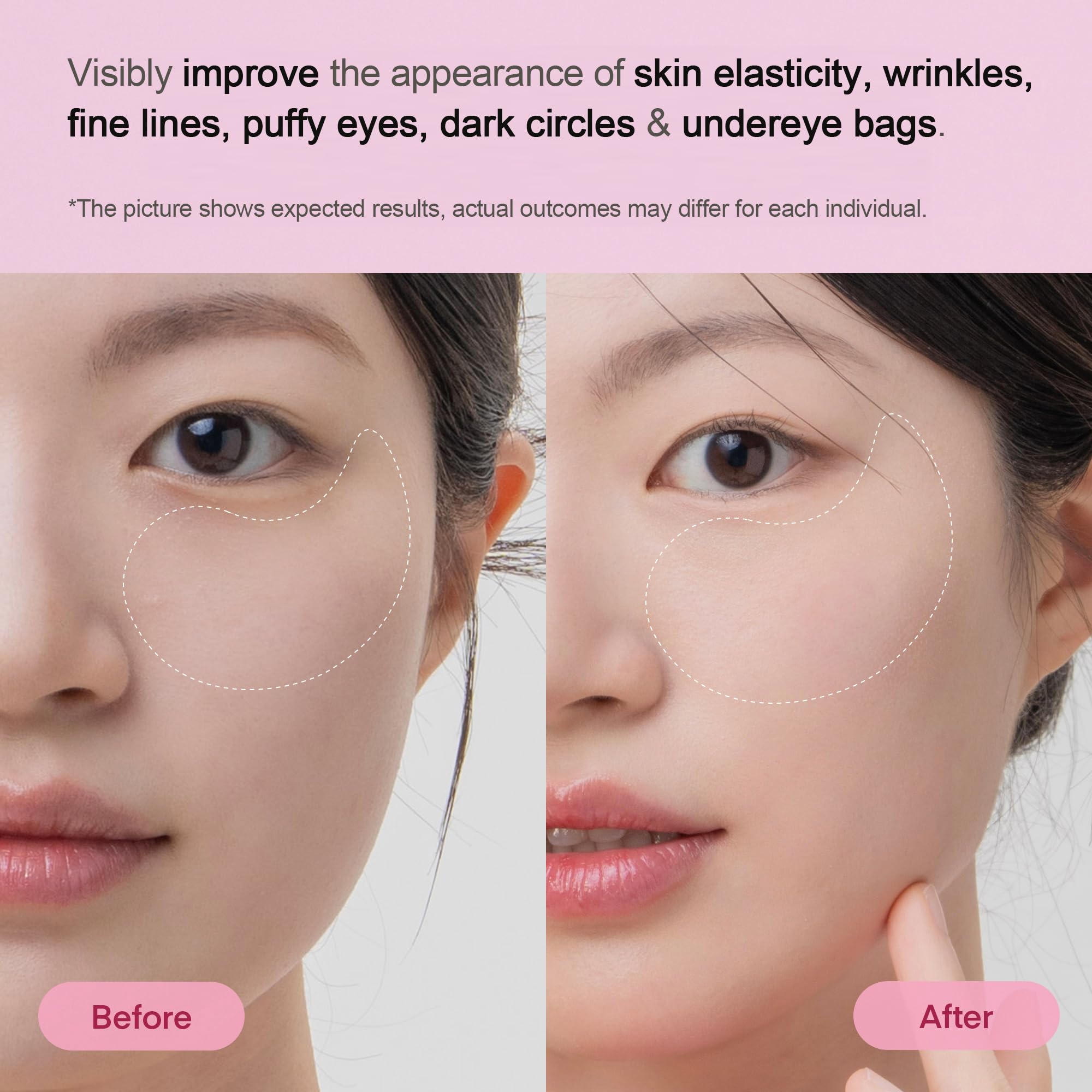 TEREZ & HONOR Collagen Peptide Under Eye Patches – Korean Firming Hydration, 6 Pairs, Travel & Gift Ready