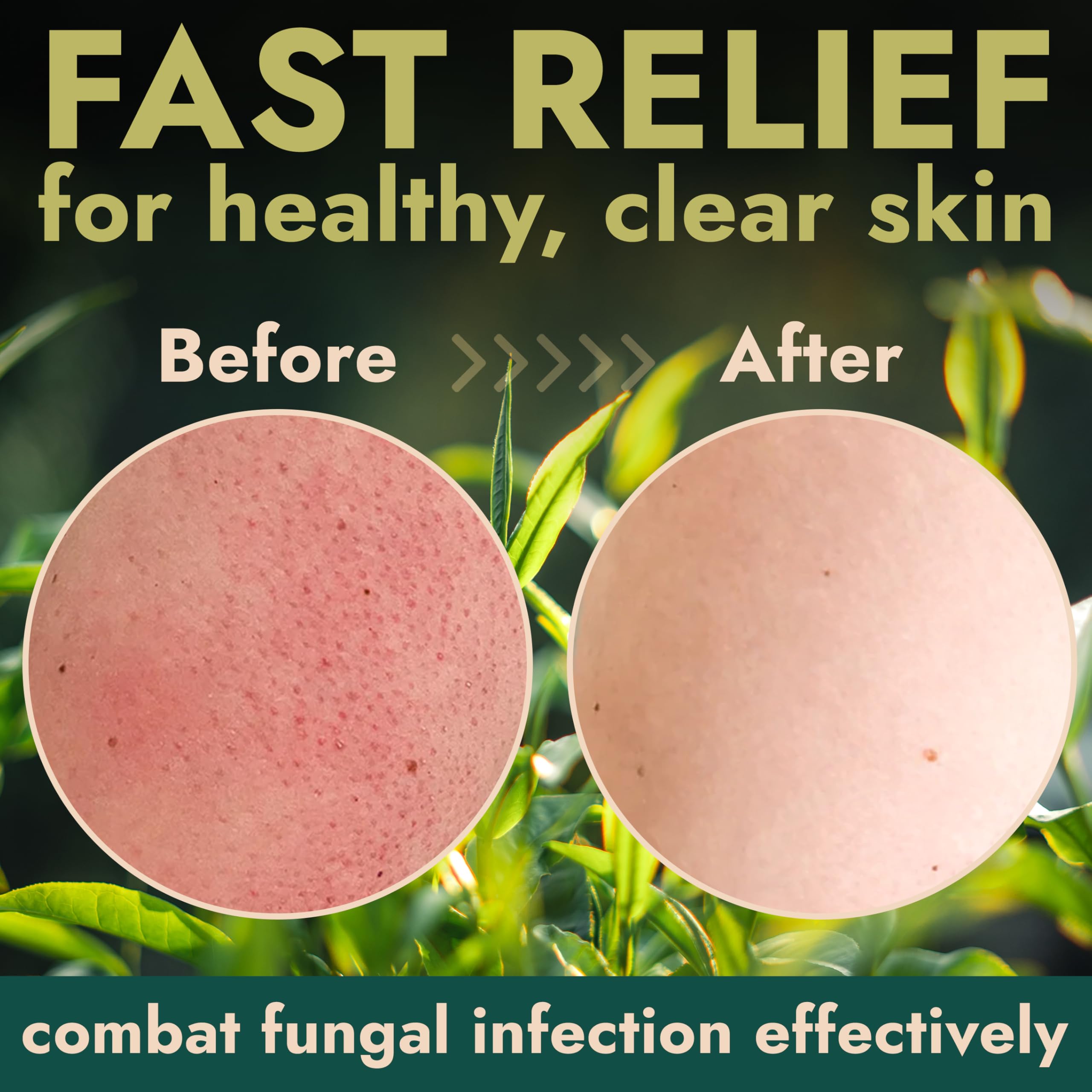 Terramed Just Think Comfort Antifungal Body Scrub with Tea Tree Oil – Exfoliating Body Wash, 12 Fl oz with Scrubber Brush