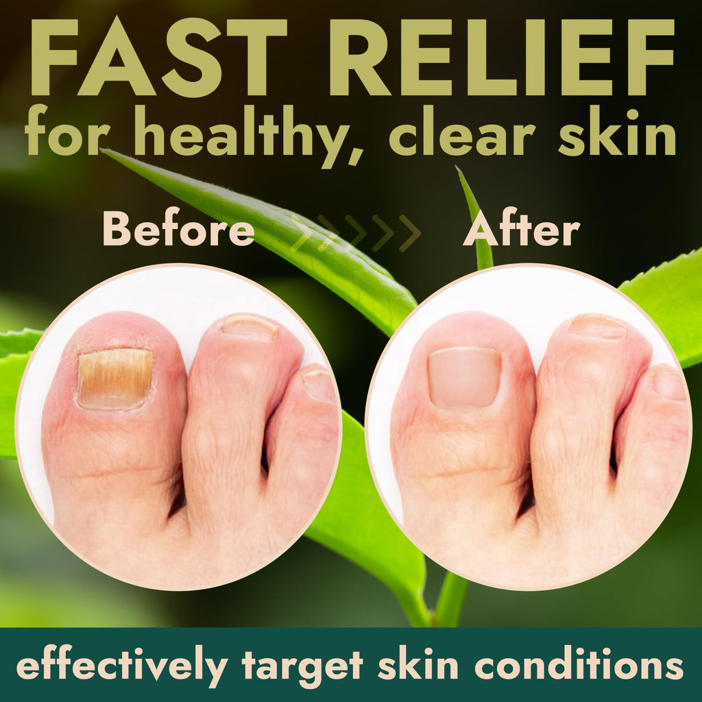 Terramed Just Think Comfort Toenail Fungus Foot Cream – Antifungal Treatment, NDC 83004-025