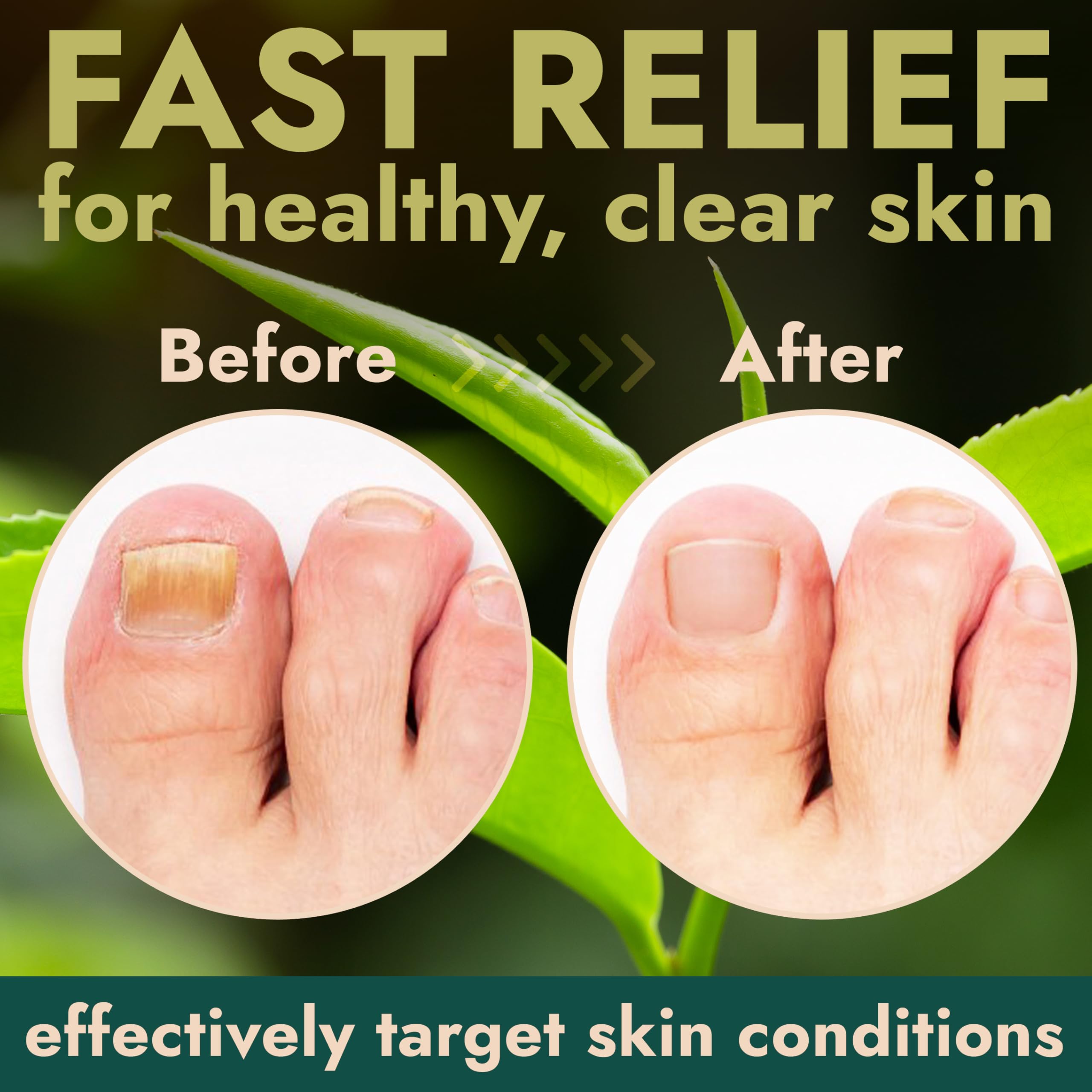 Terramed Just Think Comfort Toenail Fungus Foot Cream – Antifungal Treatment, NDC 83004-025