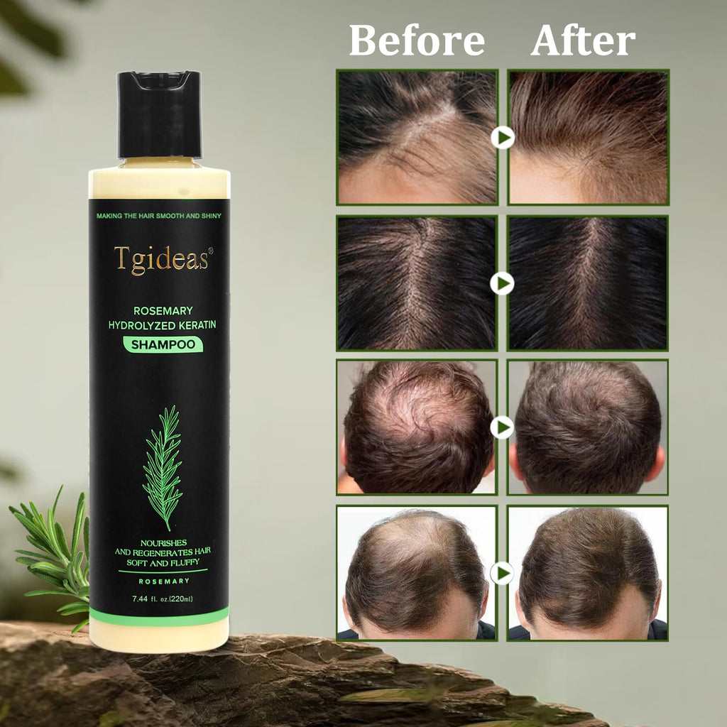 Tgideas Organic Rosemary Hair Growth Shampoo for Women & Men – Thickening & Strengthening with Hydrolyzed Keratin | 2 x 7.4 fl oz