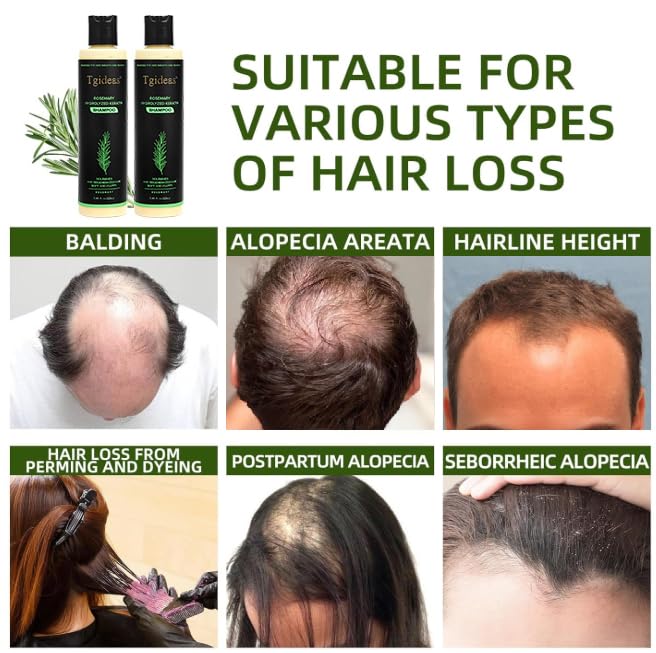 Tgideas Organic Rosemary Hair Growth Shampoo for Women & Men – Thickening & Strengthening with Hydrolyzed Keratin | 2 x 7.4 fl oz