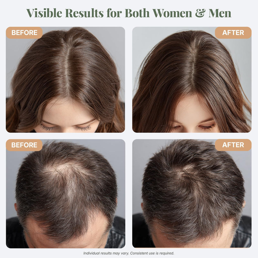 The ELIX USDA Organic Rosemary Oil for Hair Growth – Thickening Formula with Castor & Pumpkin Seed | Made in USA | 4oz