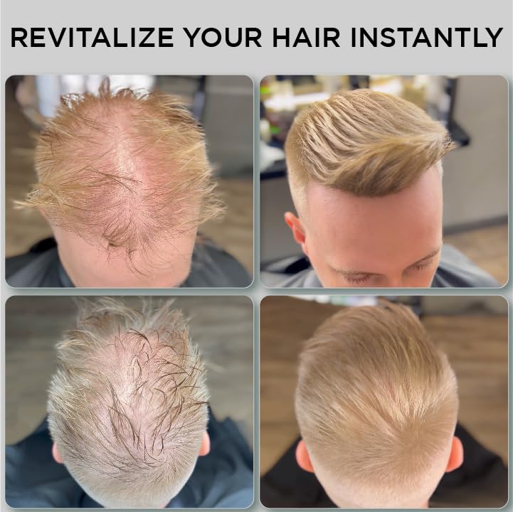 THICK FIBER Hair Fibers for Thinning Hair & Bald Spots – Medium Blonde (25g) | Conceal Hair Loss