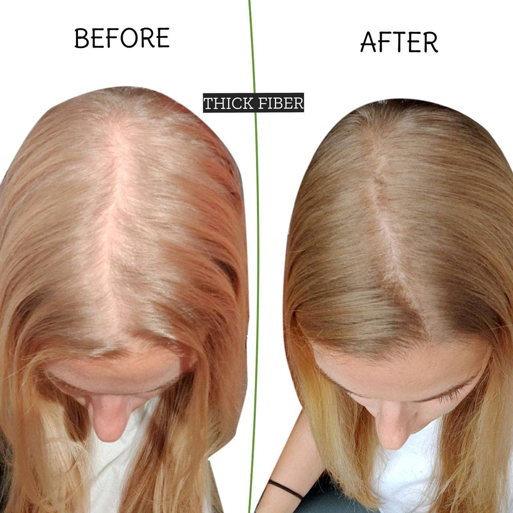THICK FIBER Hair Fibers for Thinning Hair & Bald Spots – Medium Blonde (25g) | Conceal Hair Loss
